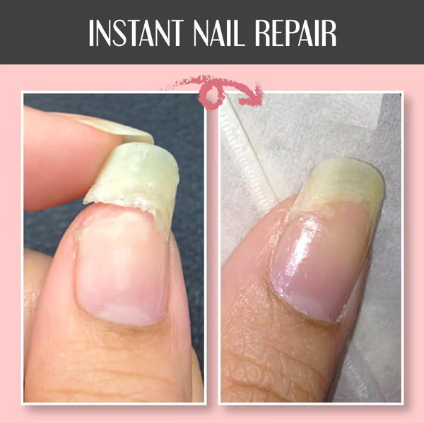 Gel Reparador e Protetor para Unhas: Fortalece e Regenera 