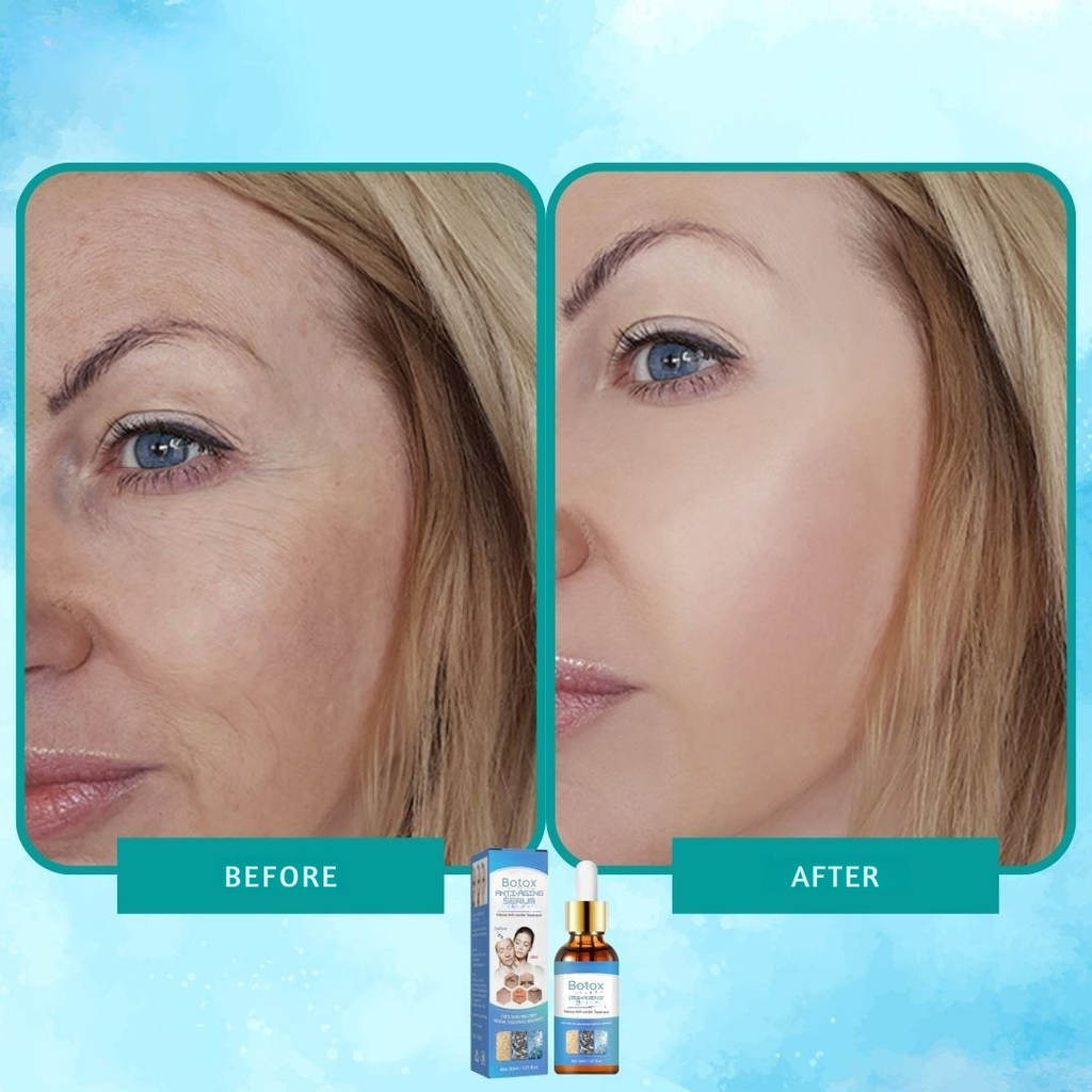 Serum botox elixir anti-rynker intens 