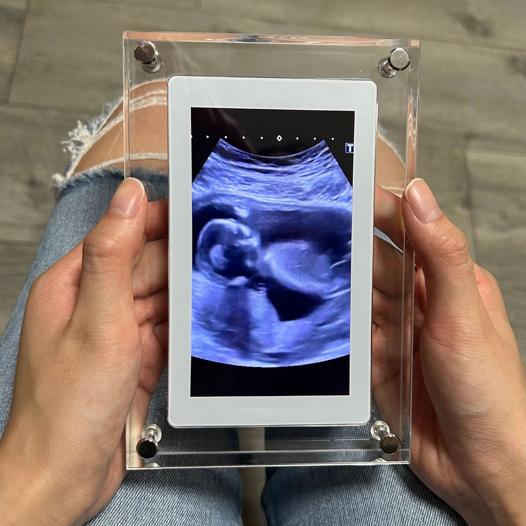 Light digital frame for unforgettable memories 